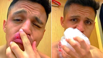 Imagen 6RL2G7IY6BCUFIRXB52XBFY6CM