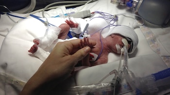 Juana, a los 11 días,