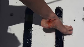 La profunda herida en el tobillo de Cavalli. Perdió mucha sangre y debió ser trasladada a un hospital de Miami (YouTube)