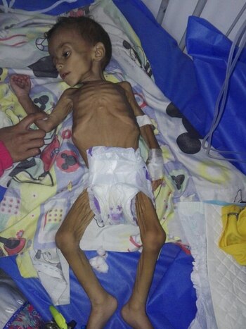 Jean Pierre Planchart tiene un