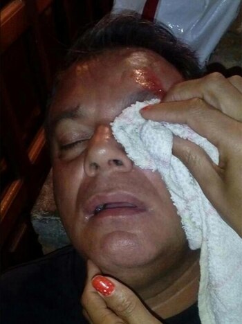 El concejal de San Cristóbal, Vincenzo Pallotini, también resultó herido