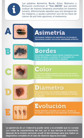 El método ABCDE para revisar