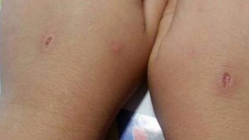 Una víctima del “abecedario”