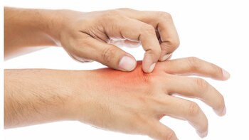 Tocar la zona afectada por