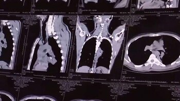 Los médicos le realizaron tomografías