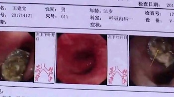 La tapa del bolígrafo estaba