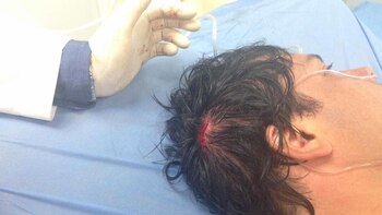 Carlos Paparoni fue herido este