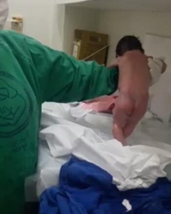 El reflejo de marcha automática