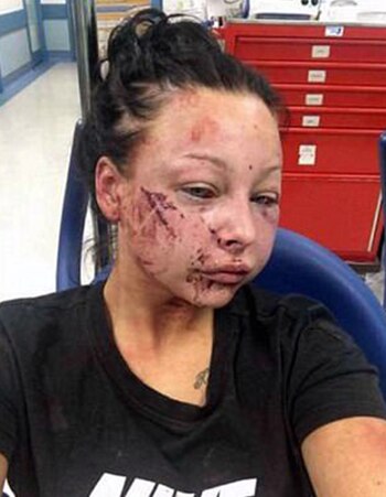 Jenna debió ser atendida en