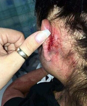 La golpeó hasta dejarla inconsciente,