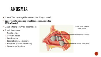 Gráfico ilustrativo de la enfermedad