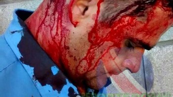 El episodio se produjo en la localidad de La Matanza (Gentileza Reportero24hd)