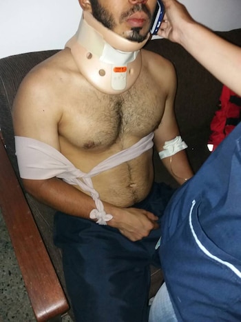 “Me dieron con la culata del rifle, me golpearon con una bomba lacrimógena en la cabeza y me abrieron una herida”, dijo el joven