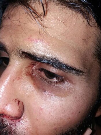 “Tenía mi casco y estaba identificado con el uniforme de la universidad e, indiscriminadamente, me golpearon”, señaló