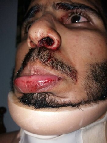 El joven denunció haber sufrido una salvaje agresión de parte de miembros de la Guardia Nacional Bolivariana cuando atendía a manifestantes heridos