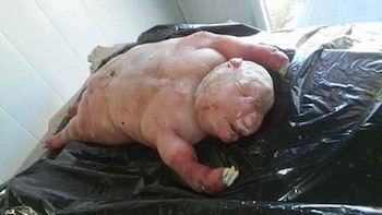 Las fotos del hombre-cordero se