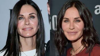 El antes y después de