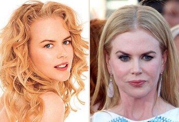 Nicole Kidman, un antes y