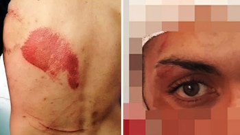 Imagenes que ilustran el informe