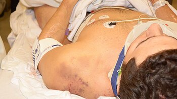 Nicholas Kollias fue tratado por