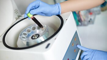 Mediante un proceso de centrifugación se pueden separar las plaquetas de la sangre (iStock)