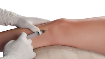 El plasma rico en plaquetas forma parte de lo que se conoce como terapias regenerativas (iStock)