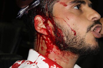 Armando Armas fue brutalmente agredido