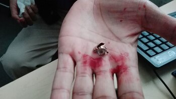 Denuncian que hubo detonaciones en