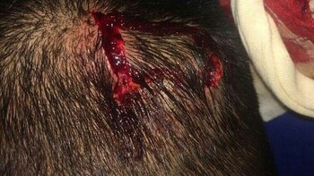 Otra de la imágenes de