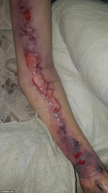 Así quedó el brazo de