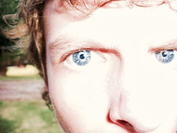 Un patrón inusual de iris