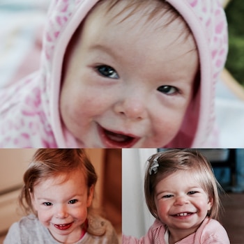 El cuadro clínico de pacientes