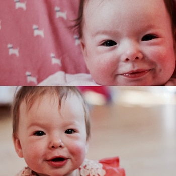 Quienes padecen de Williams suelen