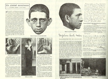 El conmocionante caso del Petiso