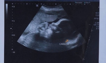 (Gentileza Agencia O Globo)