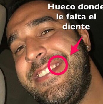 Ciardone publicó más fotos de