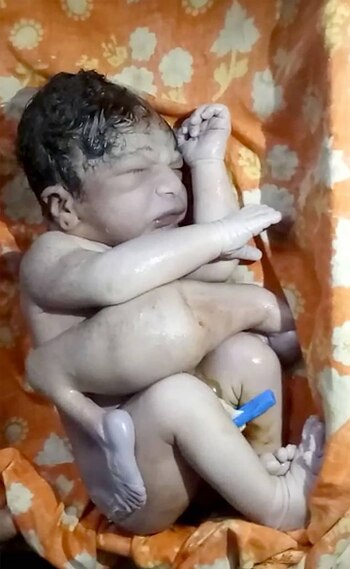 El niño nació en un