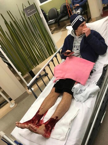 Sam Kanizay recién llegado al hospital (Jarrod Kanizay, vía AP)