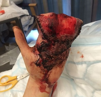 Así quedó la mano tras