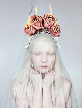 Nastya Zhidkova es albina