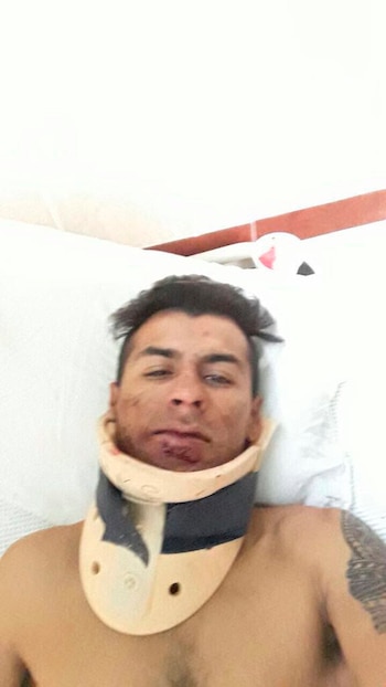 El jockey sufrió heridas en