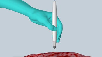 El dispositivo detecta rápidamente y