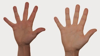 Por lo general, los hombres