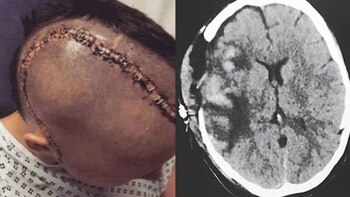 Imagen BBNXVVFTGVGCVA6BWW2Z2SPTWE