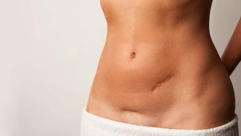 Las cicatrices son reparaciones de