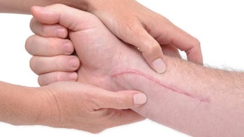 Diversos tratamientos mejoraron el aspecto