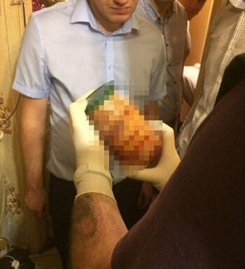 Un frasco de presuntos restos