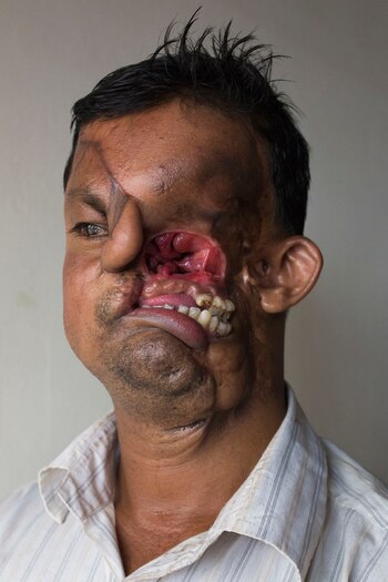 Hashmot Ali, sin la máscara