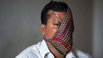 Hashmot Ali, 40 años. Fue