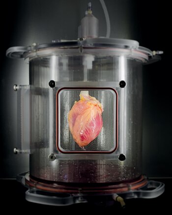 Modelo de tejido cardíaco biosintético